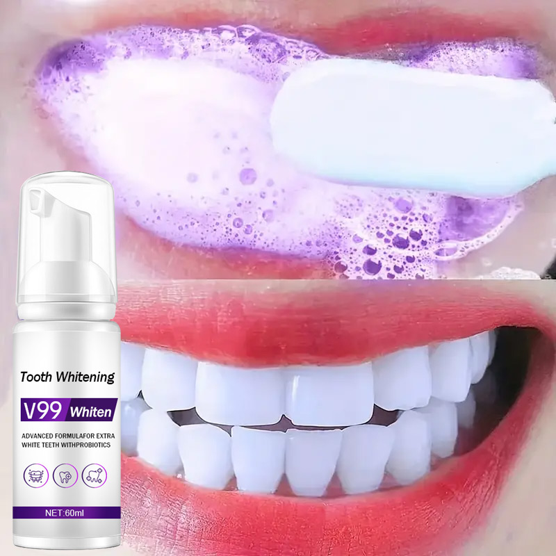 Teeth Whitening Mousse - معجون أسنان موس V99، معجون أسنان