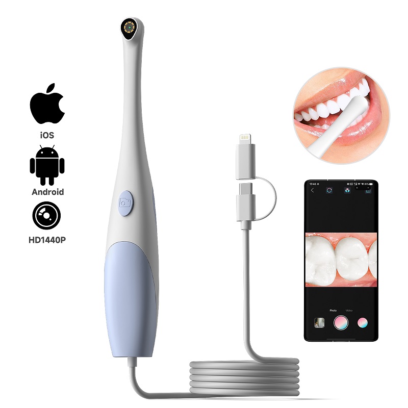 Teeth Whitening Video - كاميرا منظار الفم بدقة 1440P مع