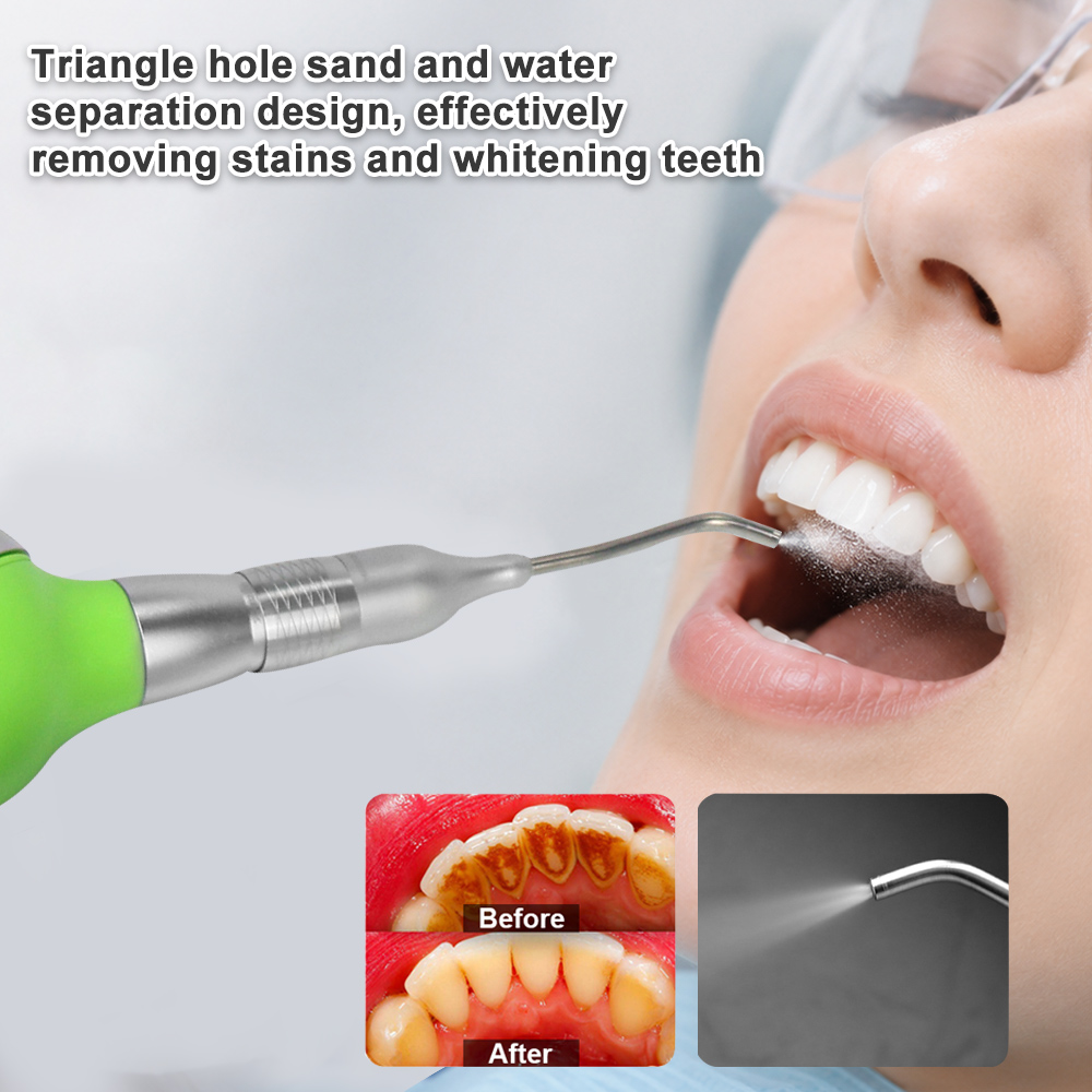 جهاز تلميع الأسنان الهوائي مع  - مراجعة Teeth Whitening Options وسعره