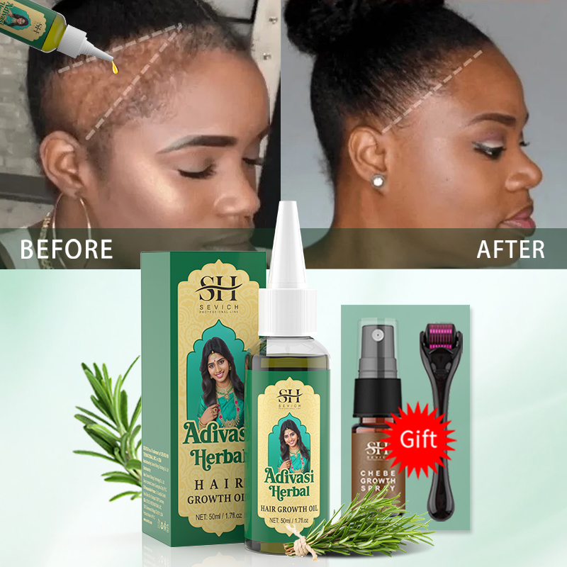 زيت نمو الشعر الأيورفيدي الهند - مراجعة Coconut Oil Pull وسعره