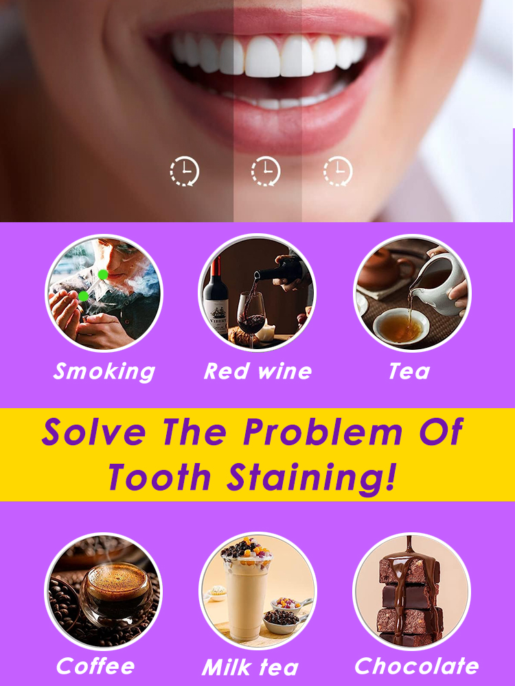 معجون أسنان بنفسجي للتبييض، تن - مراجعة Teeth Whitening Mousse وسعره