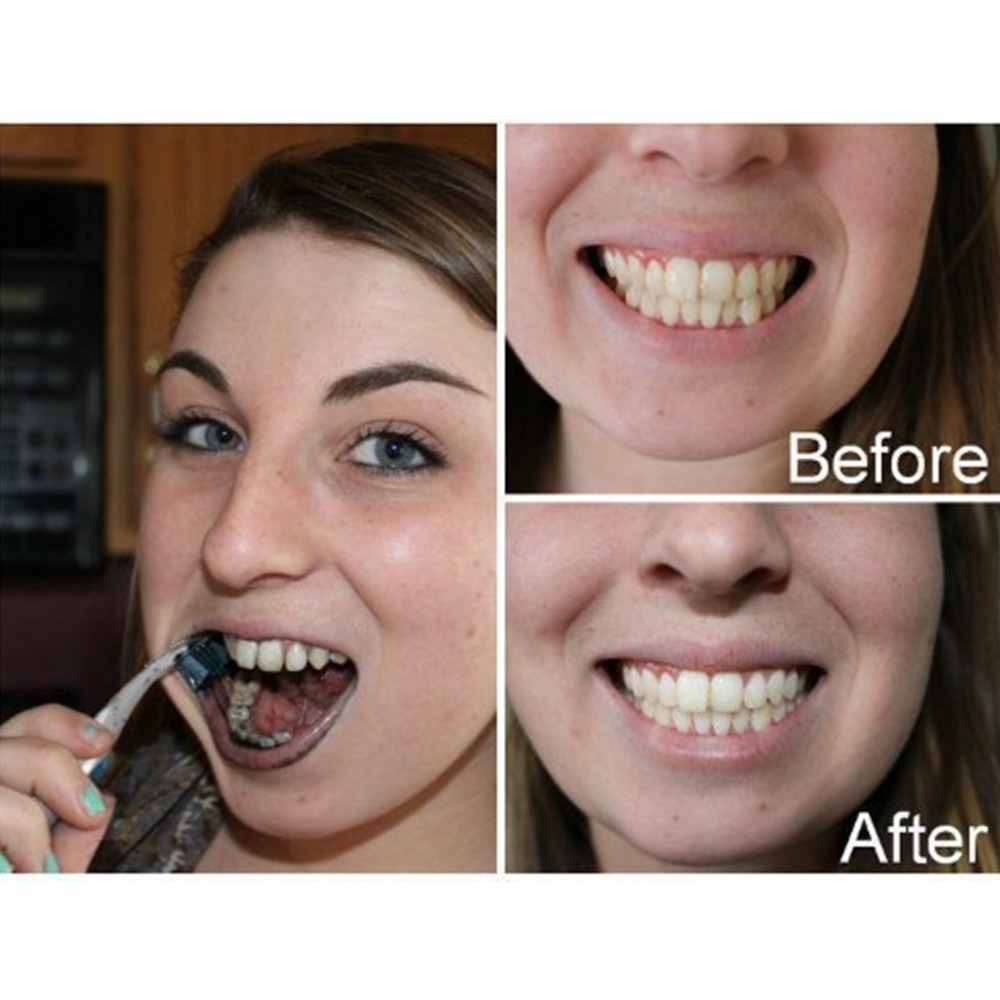 الخيزران الفحم الأسنان الأسنان - مراجعة Teeth Whitening Powder وسعره
