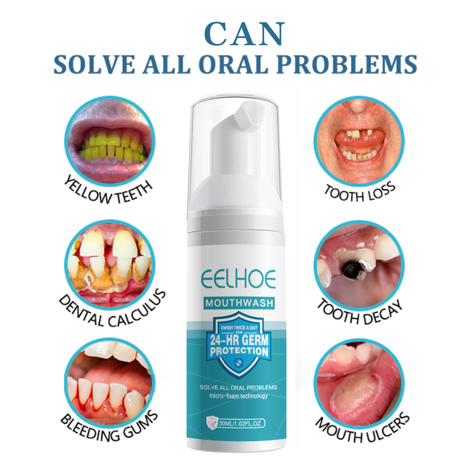EELHOE تبييض الأسنان تنظيف موس - مراجعة Teeth Whitening Mousse وسعره