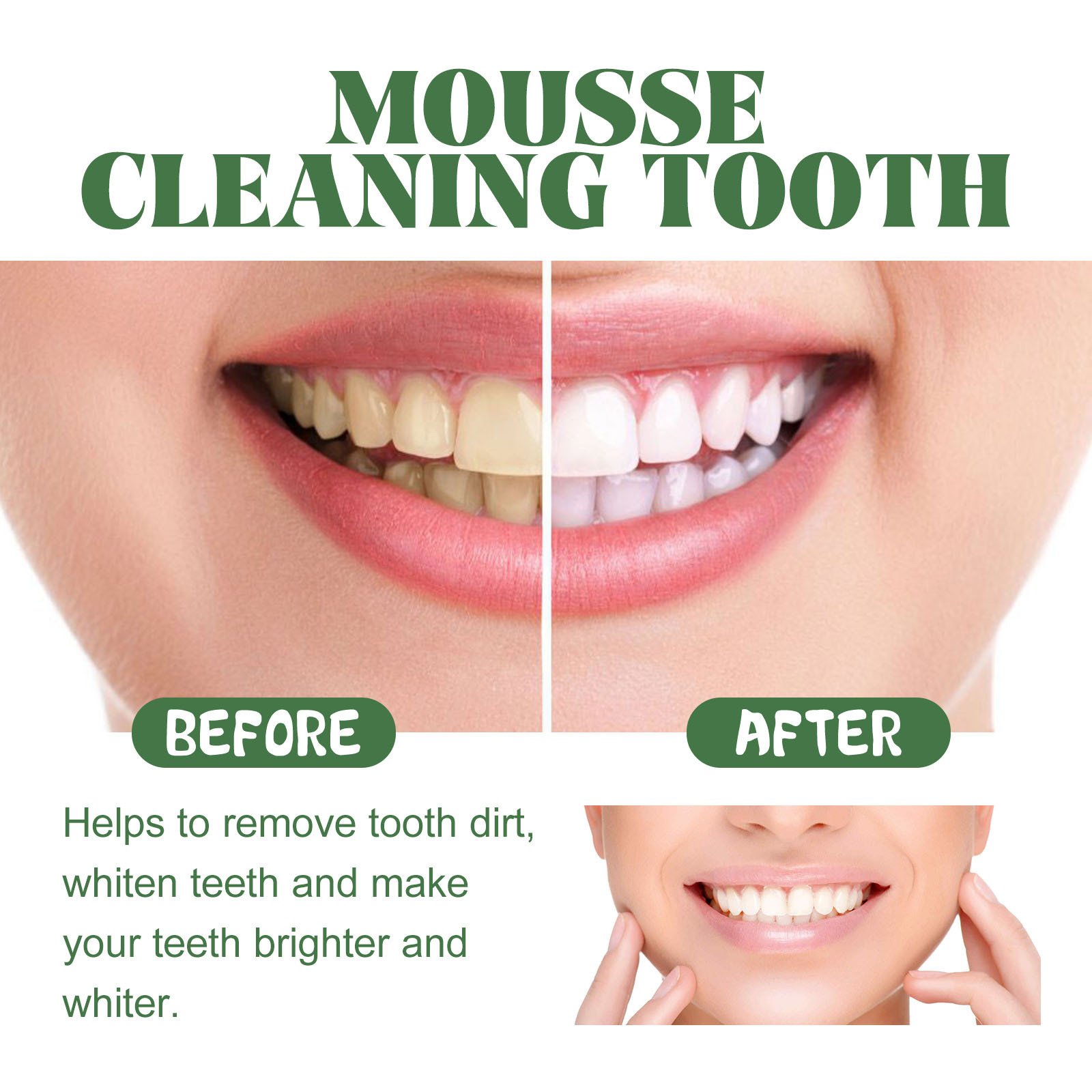 رغوة تبييض الأسنان المحمولة بح - مراجعة Teeth Whitening Mousse وسعره