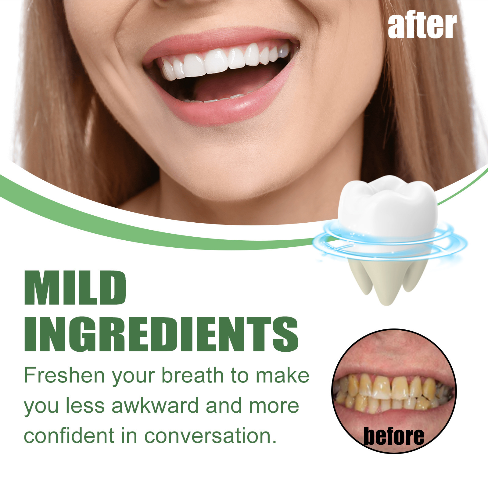 رغوة تبييض الأسنان المحمولة بح - مراجعة Teeth Whitening Mousse وسعره