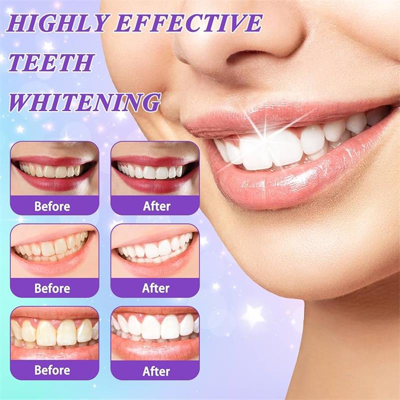 معجون أسنان 9D بنفسجي لتبييض ا - مراجعة Teeth Whitening Mousse وسعره