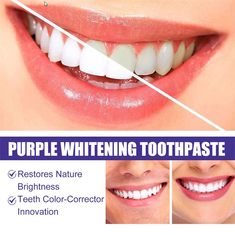 معجون أسنان 9D بنفسجي لتبييض ا - مراجعة Teeth Whitening Mousse وسعره