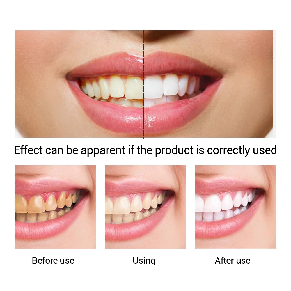 Fteenly تبييض الأسنان جوهر مسح - مراجعة Teeth Whitening Powder وسعره