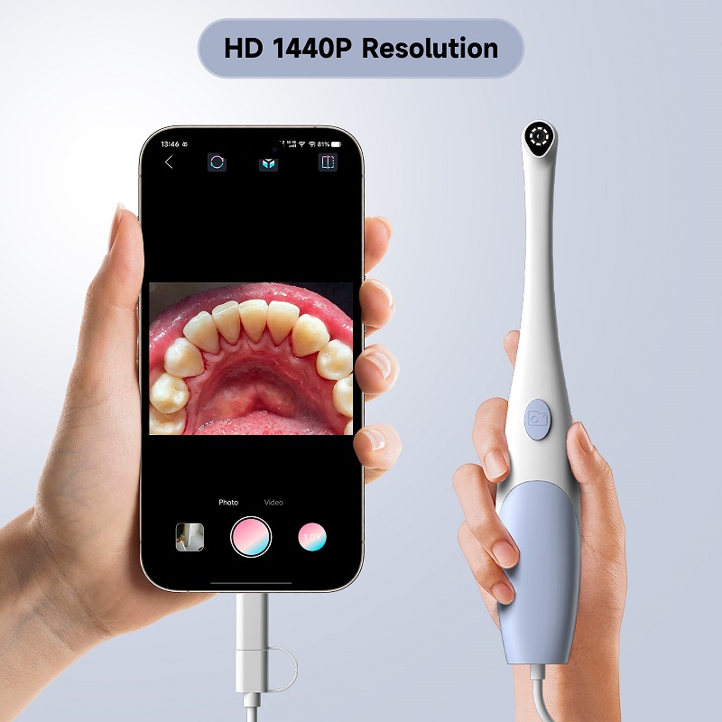 كاميرا منظار الفم بدقة 1440P م - مراجعة Teeth Whitening Video وسعره