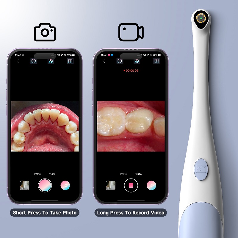 كاميرا منظار الفم بدقة 1440P م - مراجعة Teeth Whitening Video وسعره