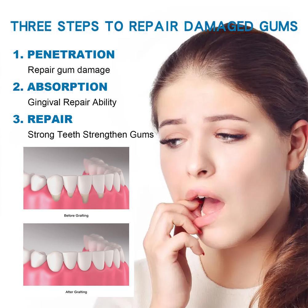 معجون أسنان للعناية بالأسنان،  - مراجعة Teeth Whitening Toothpaste وسعره