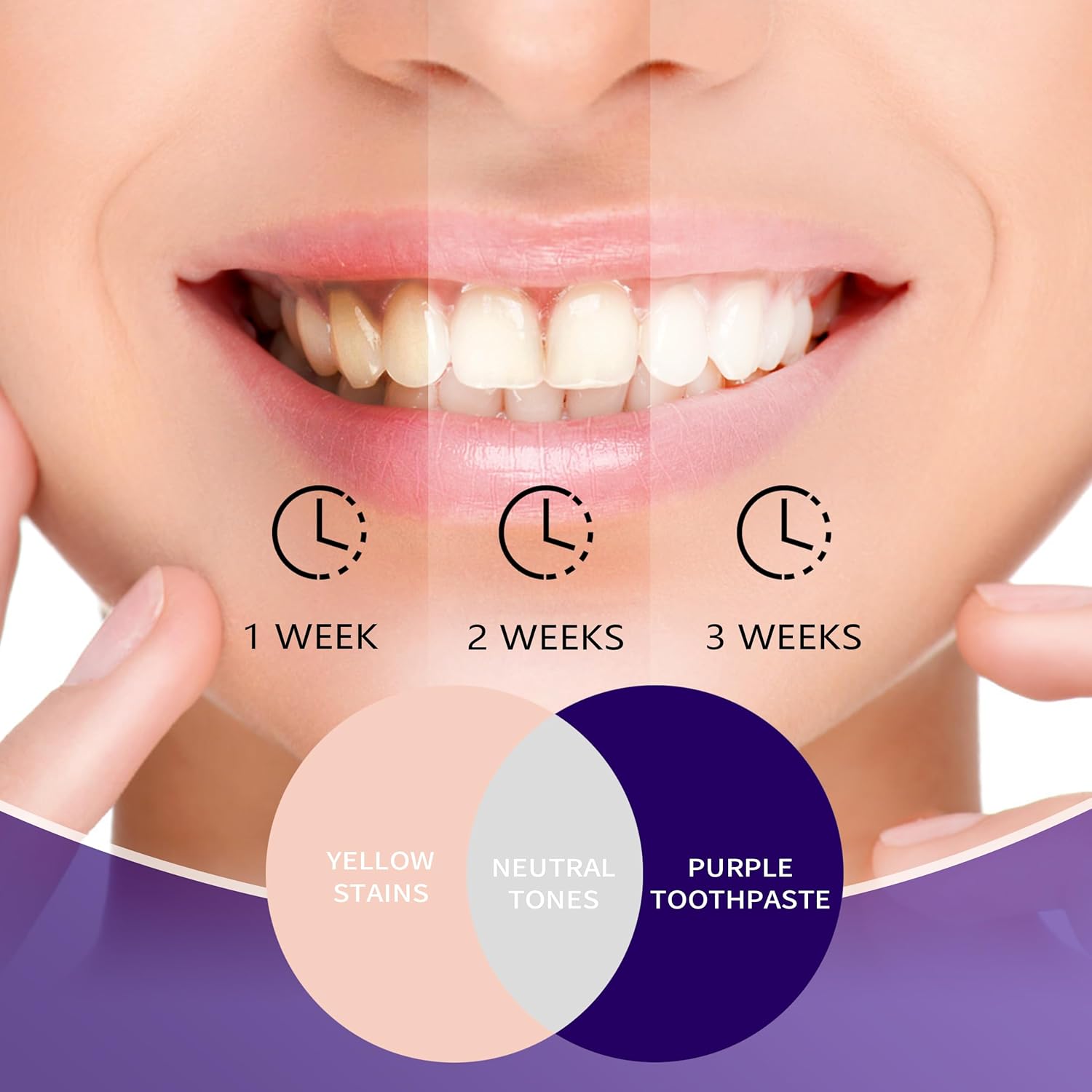 معجون أسنان أرجواني لتبييض الأ - مراجعة Teeth Whitening Mousse وسعره