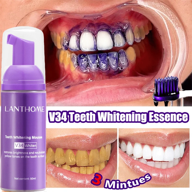 V34 معجون أسنان موس لتبييض الأ - مراجعة Teeth Whitening Mousse وسعره