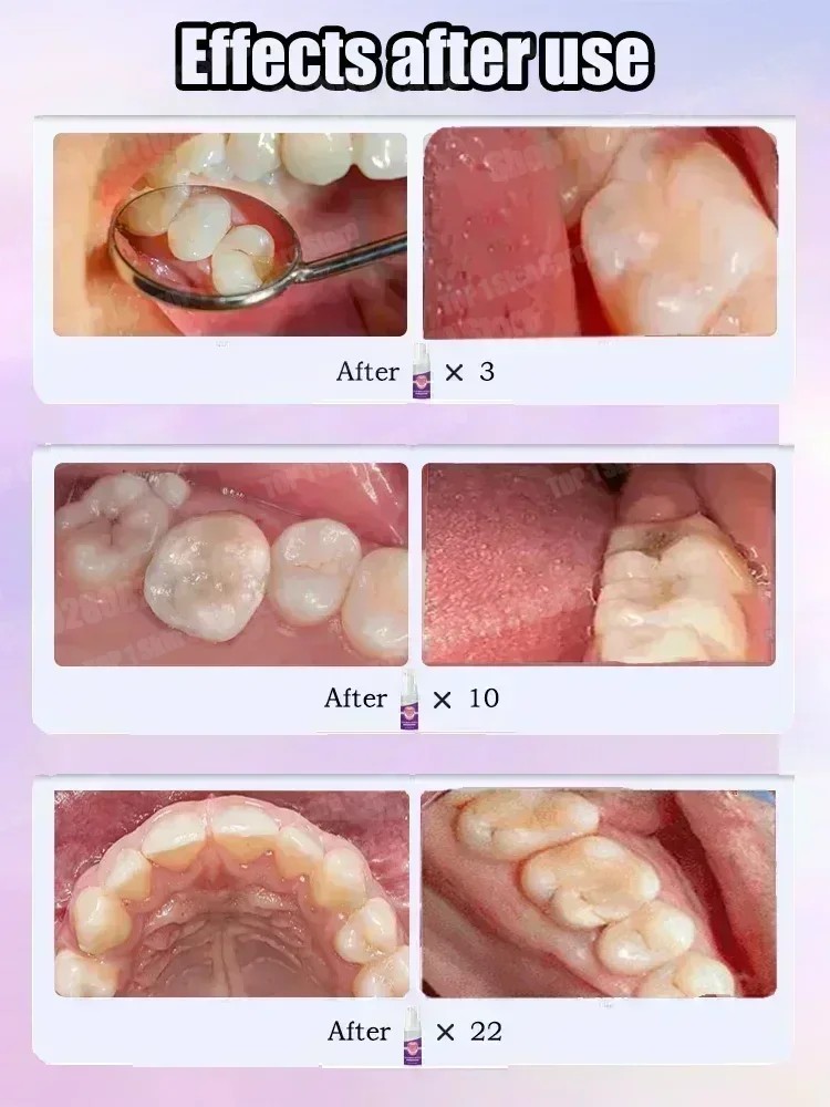 المبيعات الساخنة الأكثر مبيعًا - مراجعة Teeth Whitening Toothpaste وسعره