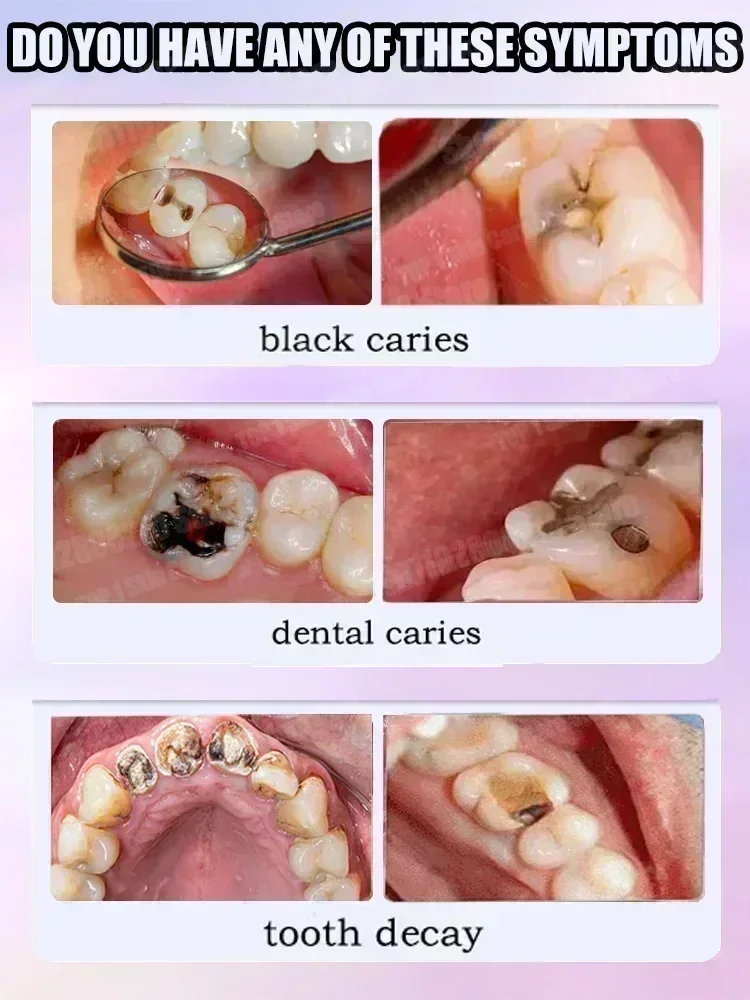 المبيعات الساخنة الأكثر مبيعًا - مراجعة Teeth Whitening Toothpaste وسعره