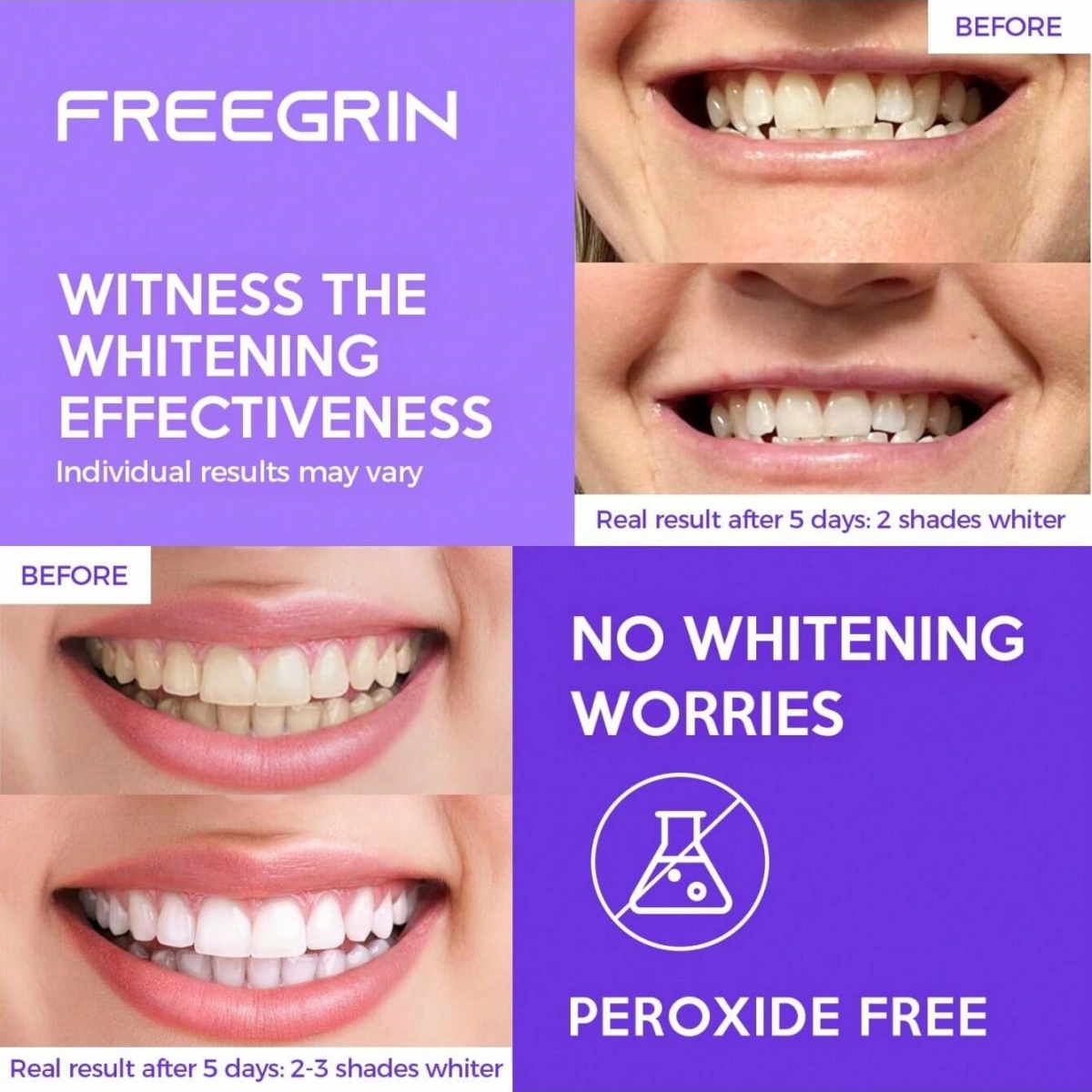 ديلوكس تبييض الأسنان ملصقات 7/ - مراجعة Teeth Whitening Price وسعره