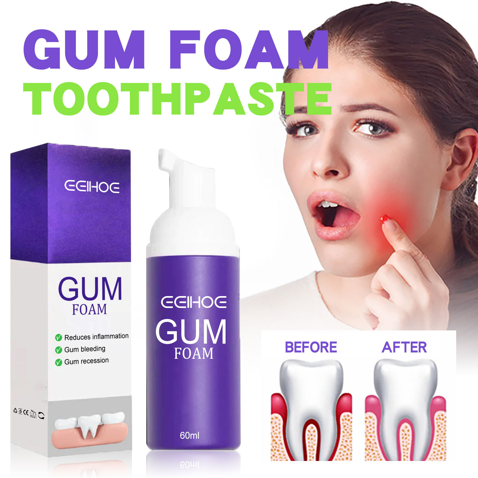 60 مللي موس تبييض الأسنان V34  - مراجعة Teeth Whitening Mousse وسعره